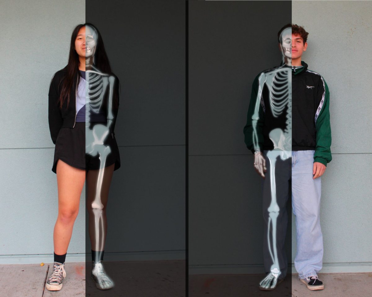 More than skin-deep: Students share journeys with concealed health conditions