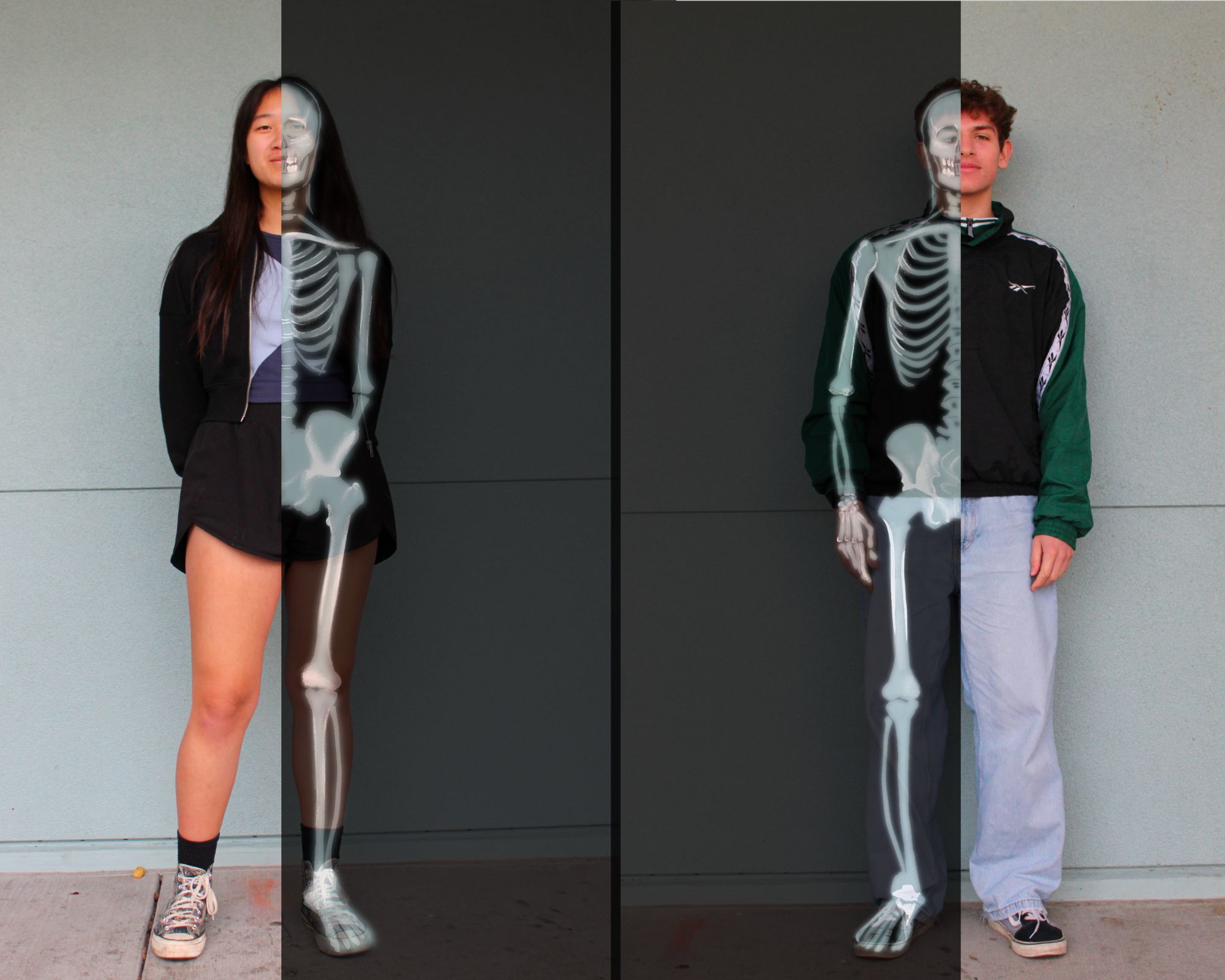 More than skin-deep: Students share journeys with concealed health conditions