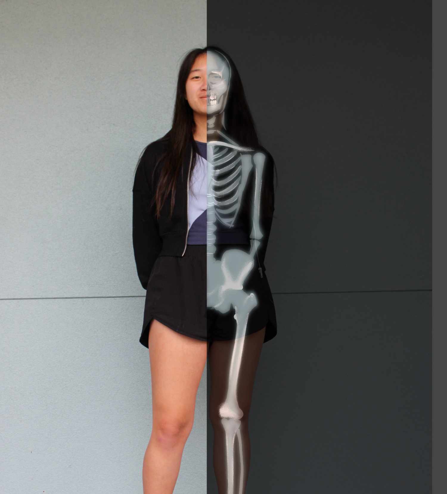 Sophomore Stella Xue: Os Trigonum